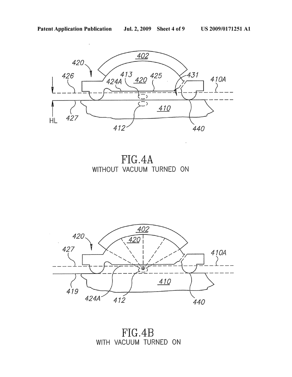 ULTRASOUND TREATMENT OF ADIPOSE TISSUE WITH VACUUM FEATURE - diagram, schematic, and image 05