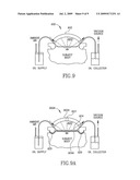 ULTRASOUND TREATMENT OF ADIPOSE TISSUE WITH VACUUM FEATURE diagram and image