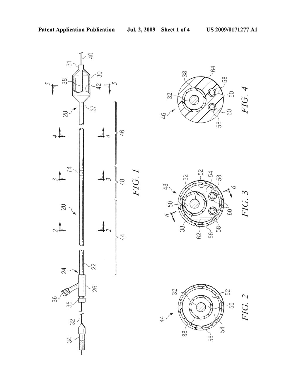 BALLOON DILATION CATHETER HAVING TRANSITION FROM COAXIAL LUMENS TO NON-COAXIAL MULTIPLE LUMENS - diagram, schematic, and image 02