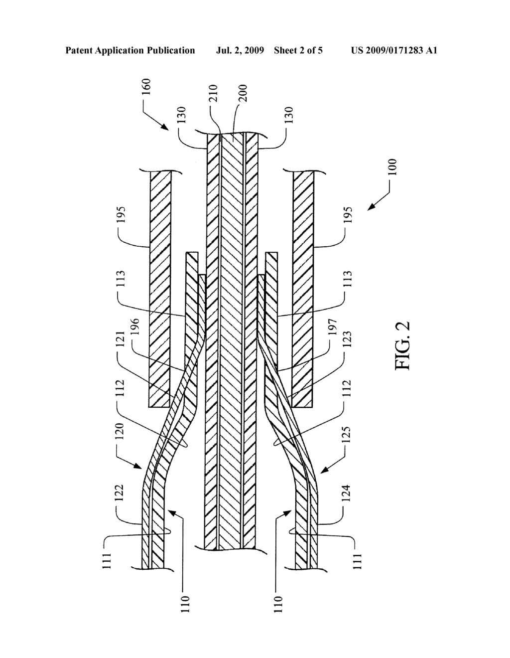 METHOD OF BONDING A DILATION ELEMENT TO A SURFACE OF AN ANGIOPLASTY BALLOON - diagram, schematic, and image 03