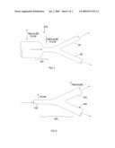 Catheter assembly and fluid supply apparatus therefor diagram and image