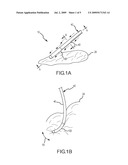 PRESSURE-SENSITIVE FLEXIBLE POLYMER BIPOLAR ELECTRODE diagram and image