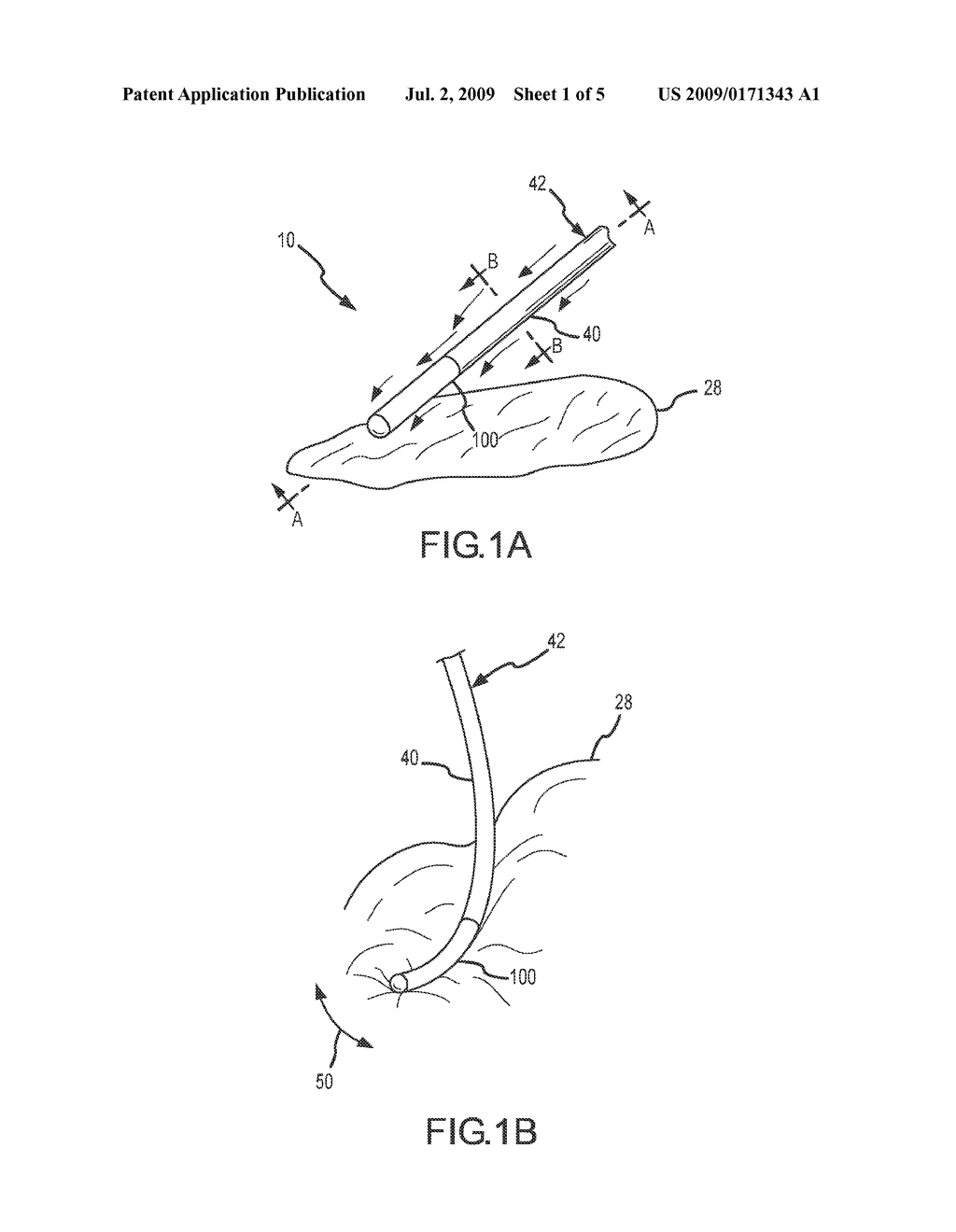 PRESSURE-SENSITIVE FLEXIBLE POLYMER BIPOLAR ELECTRODE - diagram, schematic, and image 02