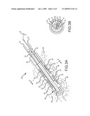 PRESSURE-SENSITIVE FLEXIBLE POLYMER BIPOLAR ELECTRODE diagram and image