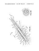 PRESSURE-SENSITIVE FLEXIBLE POLYMER BIPOLAR ELECTRODE diagram and image