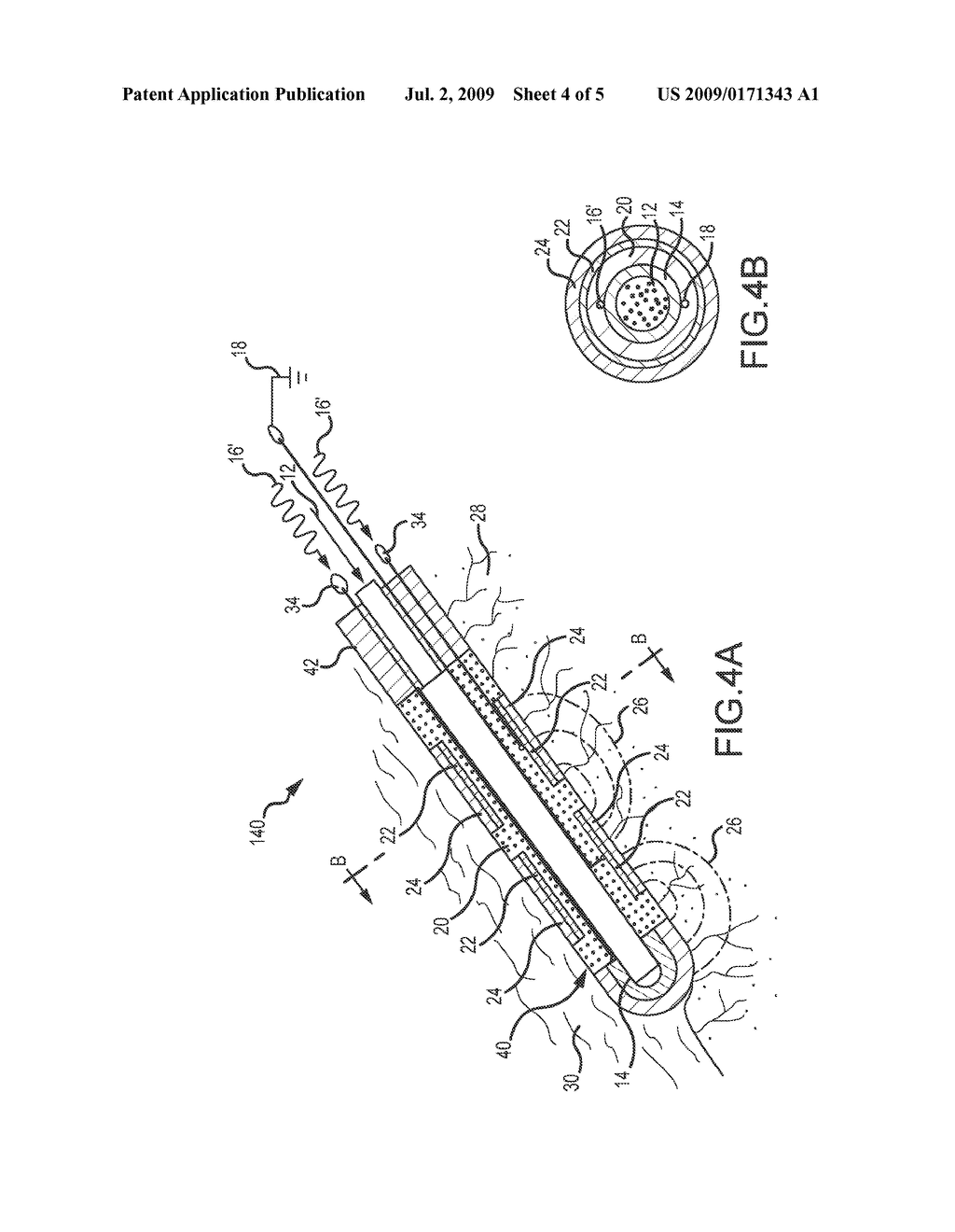 PRESSURE-SENSITIVE FLEXIBLE POLYMER BIPOLAR ELECTRODE - diagram, schematic, and image 05