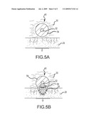 PRESSURE-SENSITIVE FLEXIBLE POLYMER BIPOLAR ELECTRODE diagram and image