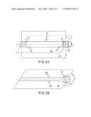 DEFLECTABLE CATHETER WITH DISTAL DEFLECTABLE SEGMENT diagram and image