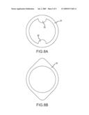 DEFLECTABLE CATHETER WITH DISTAL DEFLECTABLE SEGMENT diagram and image