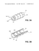 Bone Repositioning Apparatus and System diagram and image