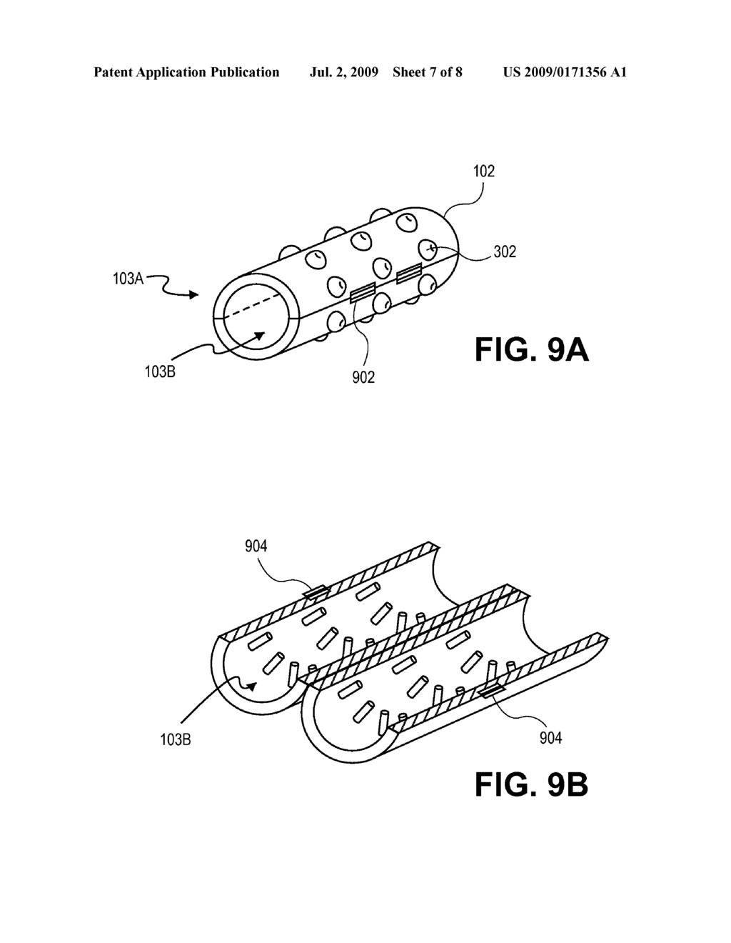 Bone Repositioning Apparatus and System - diagram, schematic, and image 08