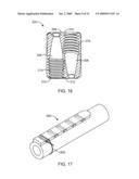 COLLET FIXATION SYSTEM diagram and image