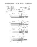 AUTOMATED INSERTION DEVICE FOR HEART VALVE PROSTHESIS diagram and image