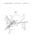 Navigation System for Hip Replacement Surgery Having Reference Mechanism and Method Using the Same diagram and image