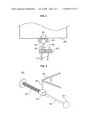 Navigation System for Hip Replacement Surgery Having Reference Mechanism and Method Using the Same diagram and image