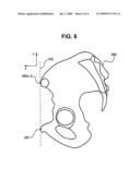 Navigation System for Hip Replacement Surgery Having Reference Mechanism and Method Using the Same diagram and image