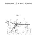 Navigation System for Hip Replacement Surgery Having Reference Mechanism and Method Using the Same diagram and image