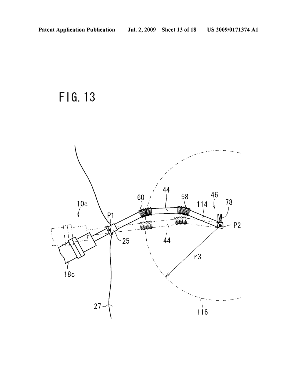 MEDICAL MANIPULATOR AND MEDICAL ROBOT SYSTEM - diagram, schematic, and image 14