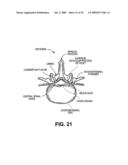 DEVICES, METHODS AND SYSTEMS FOR NEURAL LOCALIZATION diagram and image