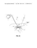 DEVICES, METHODS AND SYSTEMS FOR NEURAL LOCALIZATION diagram and image