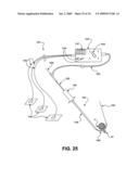 DEVICES, METHODS AND SYSTEMS FOR NEURAL LOCALIZATION diagram and image