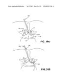 DEVICES, METHODS AND SYSTEMS FOR NEURAL LOCALIZATION diagram and image