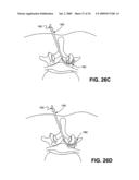 DEVICES, METHODS AND SYSTEMS FOR NEURAL LOCALIZATION diagram and image