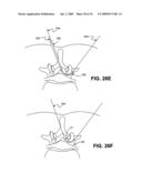 DEVICES, METHODS AND SYSTEMS FOR NEURAL LOCALIZATION diagram and image