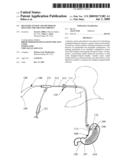 DELIVERY SYSTEM AND METHOD OF DELIVERY FOR TREATING OBESITY diagram and image