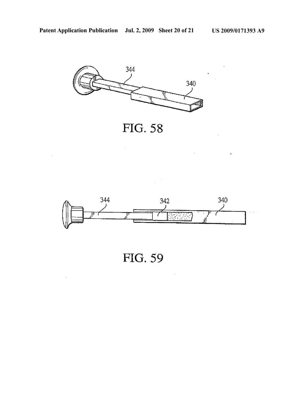 Tissue Distraction Device - diagram, schematic, and image 21