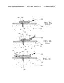 APPARATUS FOR DISCRETE TISSUE ANCHORING FOR SOFT TISSUE REPAIR AND METHOD OF USE diagram and image