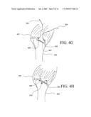 APPARATUS FOR DISCRETE TISSUE ANCHORING FOR SOFT TISSUE REPAIR AND METHOD OF USE diagram and image