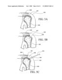 APPARATUS FOR DISCRETE TISSUE ANCHORING FOR SOFT TISSUE REPAIR AND METHOD OF USE diagram and image