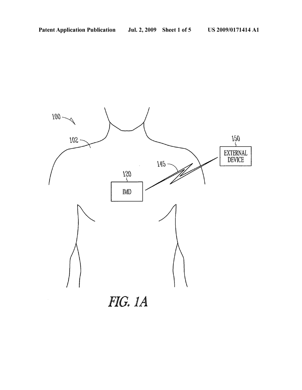 INTERROGATION OF STORED DATA IN IMPLANTABLE DEVICES - diagram, schematic, and image 02