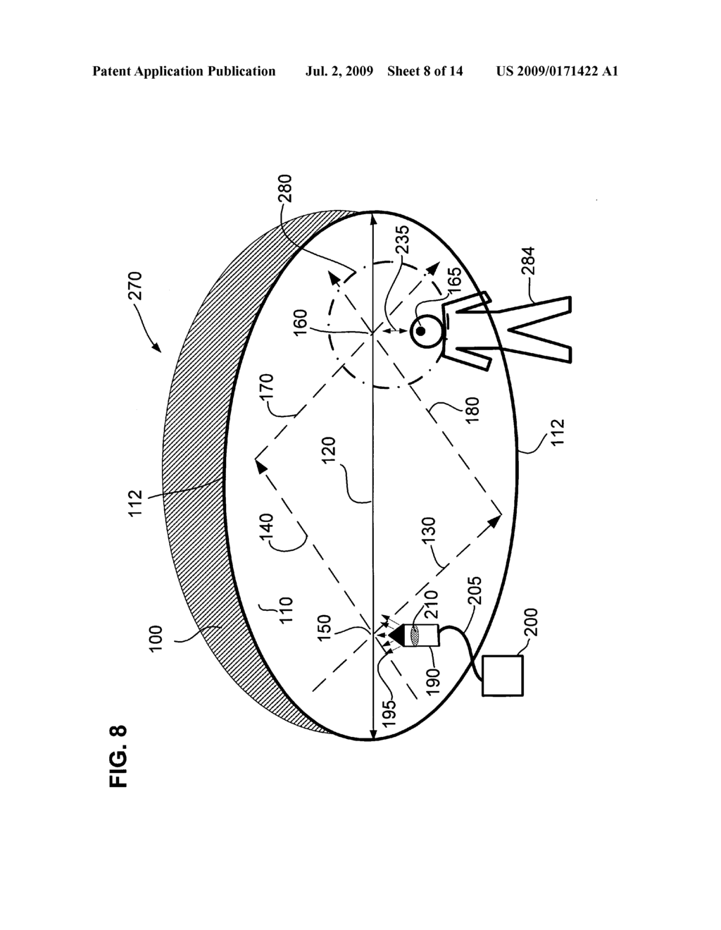 Radiation treatment device - diagram, schematic, and image 09