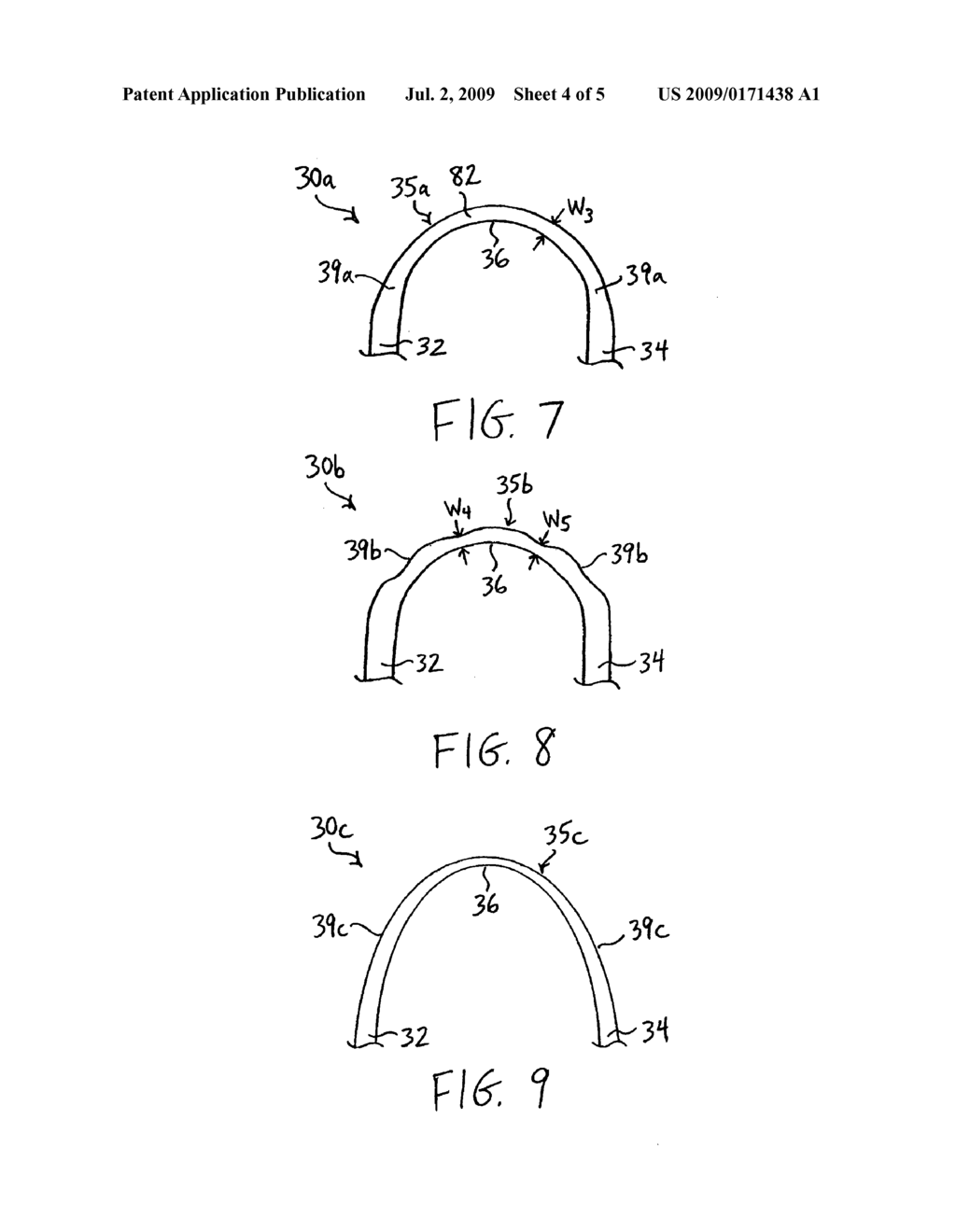 STENT HAVING LESS INVASIVE ENDS - diagram, schematic, and image 05