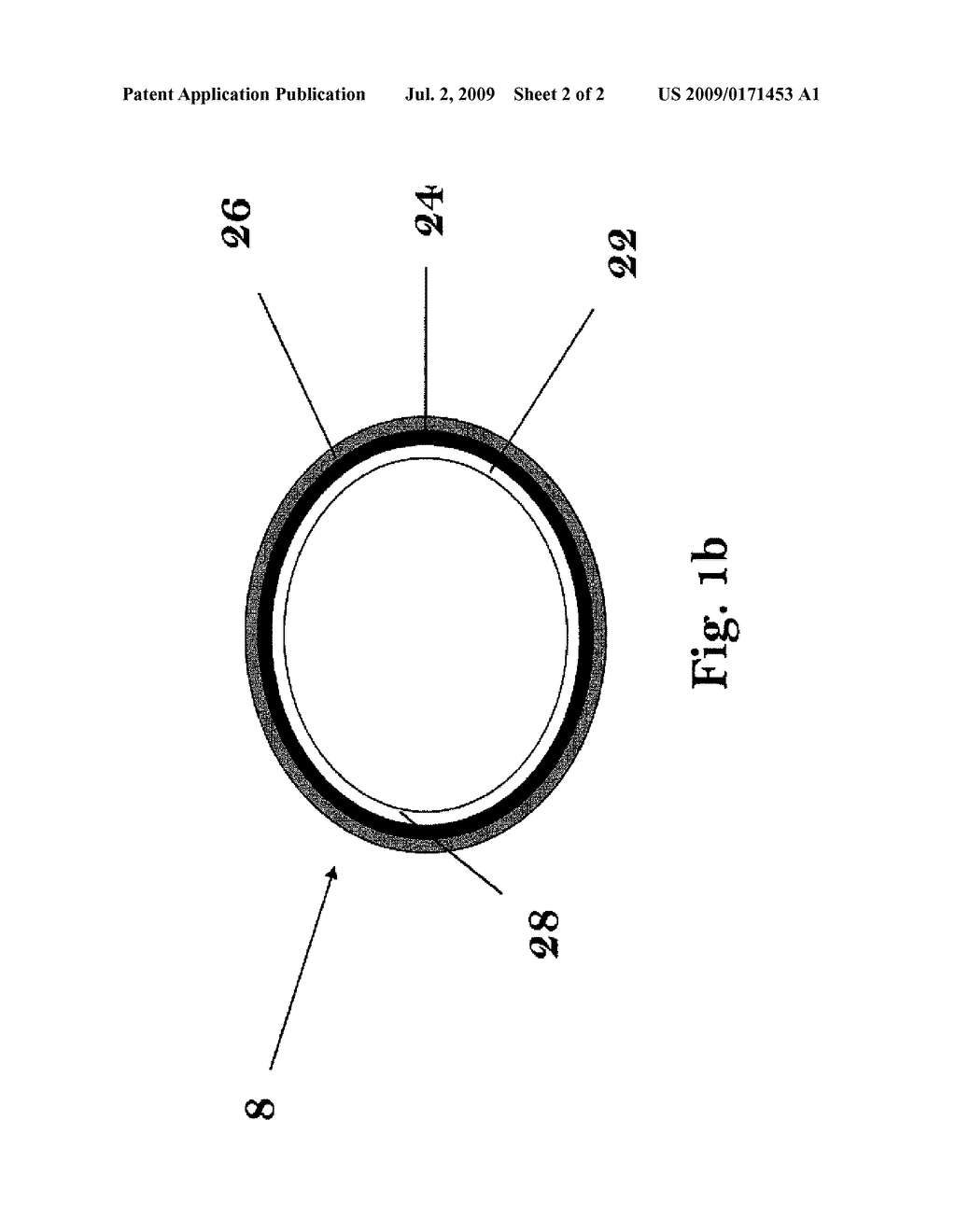 Drug Coated Stent Having a Surface Treatment and Method of Manufacturing - diagram, schematic, and image 03