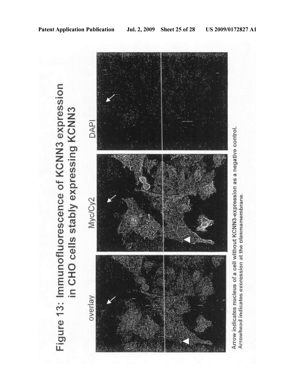 Kcnn3 as diagnostic and therapeutic target for neurodegenerative diseases - diagram, schematic, and image 26