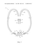 NASAL VENTILATION INTERFACE diagram and image