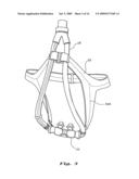 NASAL VENTILATION INTERFACE diagram and image