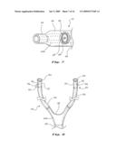 NASAL VENTILATION INTERFACE diagram and image