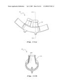 NASAL VENTILATION INTERFACE diagram and image