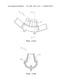 NASAL VENTILATION INTERFACE diagram and image