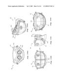 NASAL VENTILATION INTERFACE diagram and image