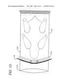 BAG SEALING SYSTEM AND METHOD diagram and image