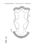 BAG SEALING SYSTEM AND METHOD diagram and image