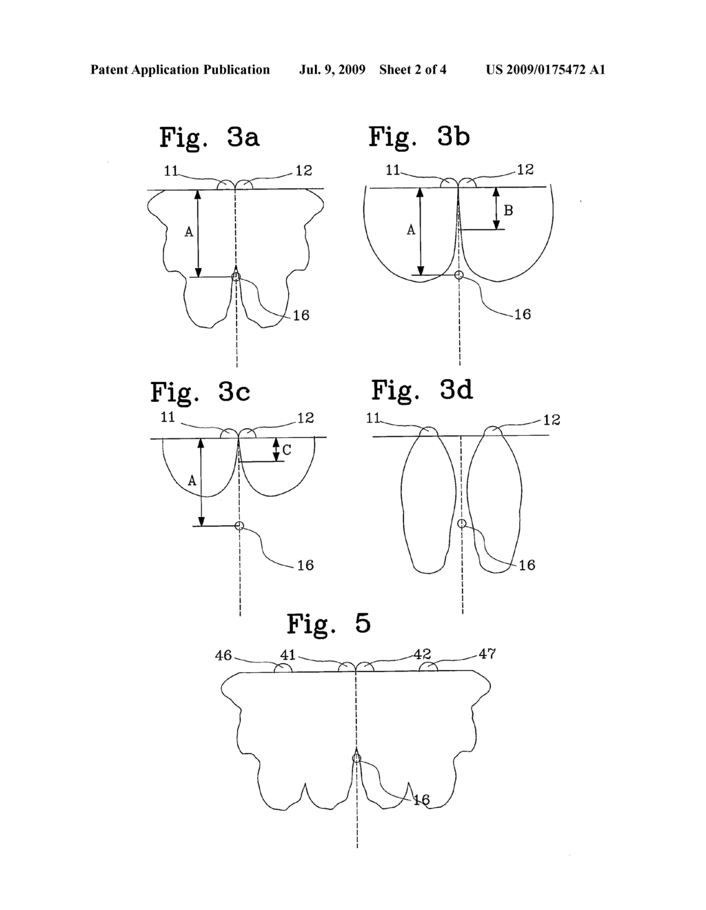 Loudspeaker Device - diagram, schematic, and image 03