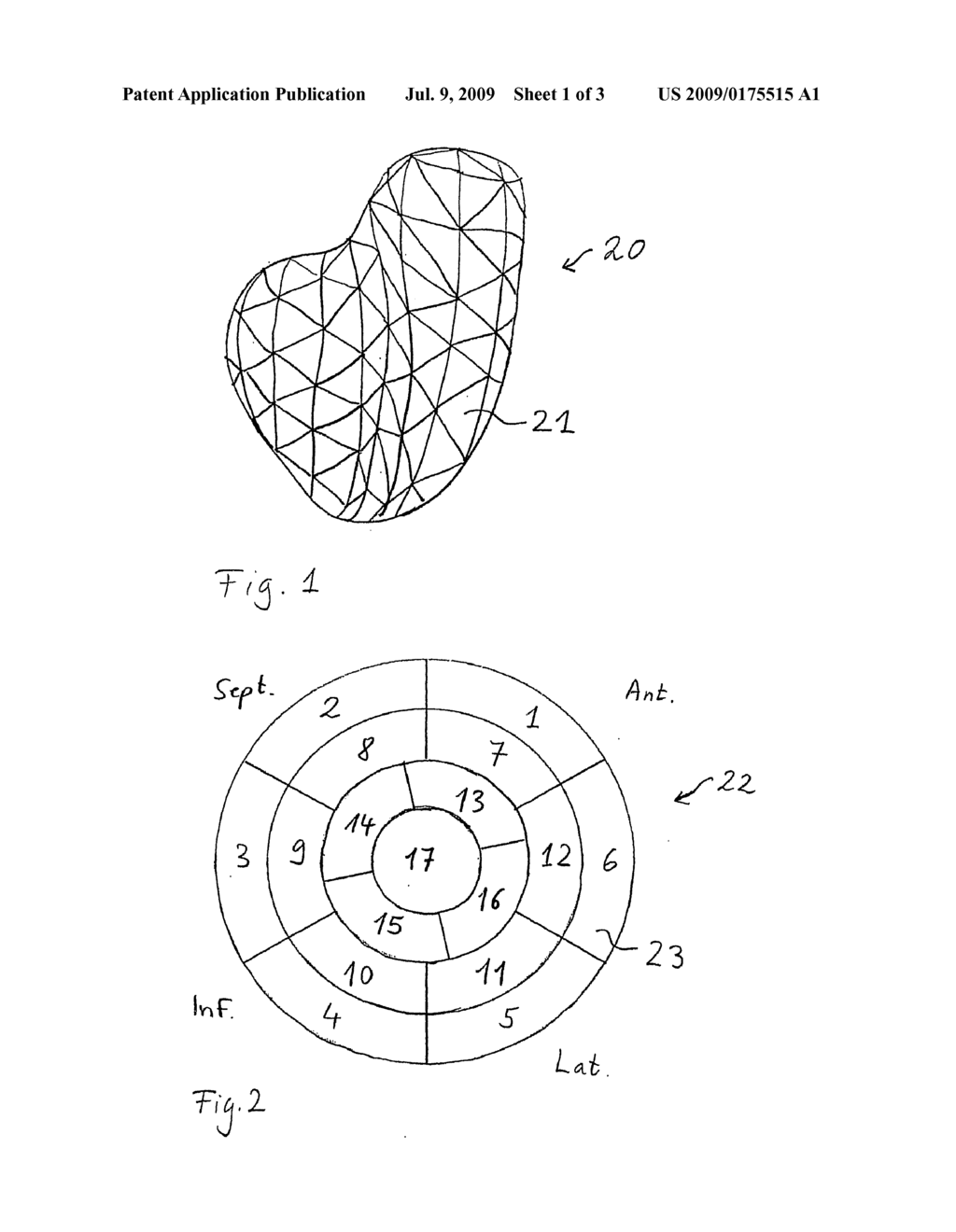 METHOD, DEVICE, AND COMPUTER PROGRAMME FOR EVALUATING IMAGES OF A CAVITY - diagram, schematic, and image 02