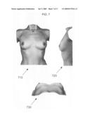 Computer analysis of a breast shape to assist breast surgery diagram and image