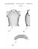 Computer analysis of a breast shape to assist breast surgery diagram and image